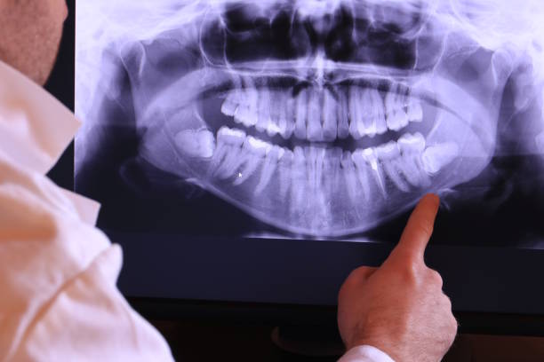 Best Dentist for Tooth Abscess  in Bayou Country Clu, LA