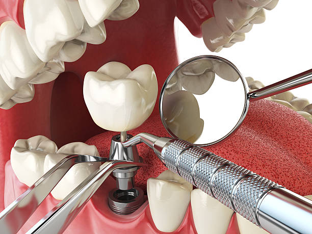 Best Emergency Gum Pain Relief  in Bayou Country Clu, LA