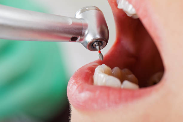 Best Tooth Infection Emergency Dentist  in Bayou Country Clu, LA